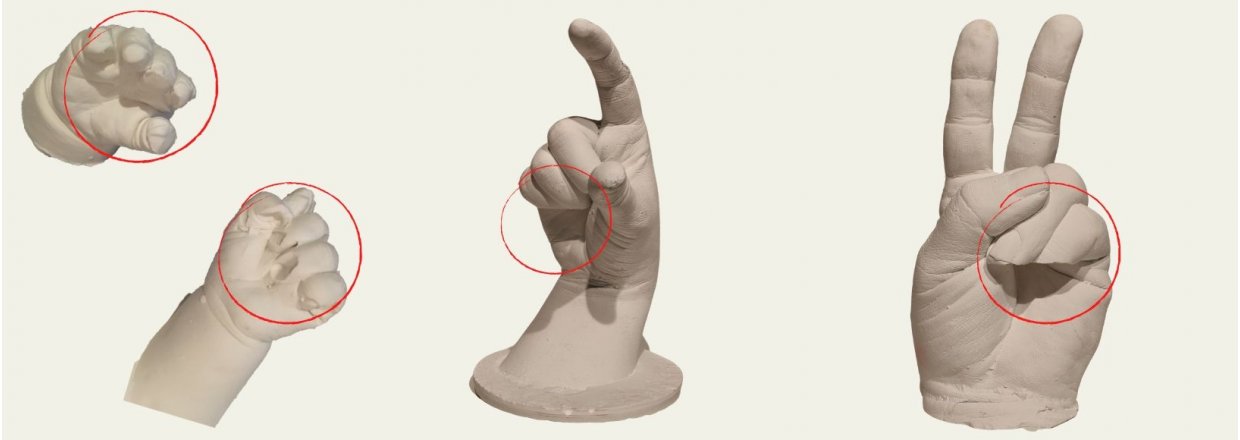 Manglende fingerspidser